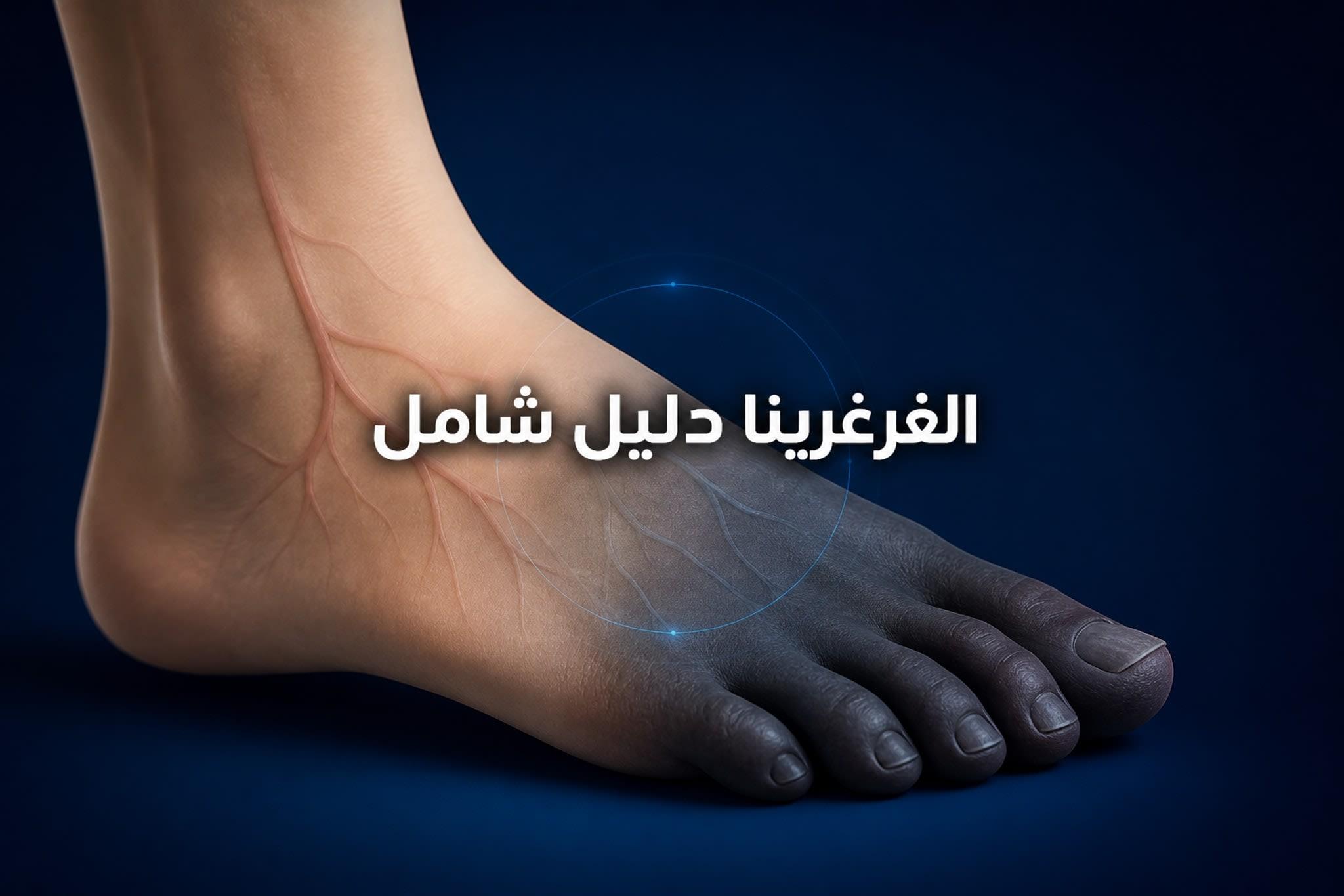 الغرغرينا: الأعراض، الأسباب، الأنواع وطرق العلاج